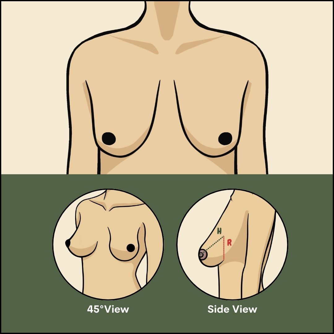 SIDE-SAG